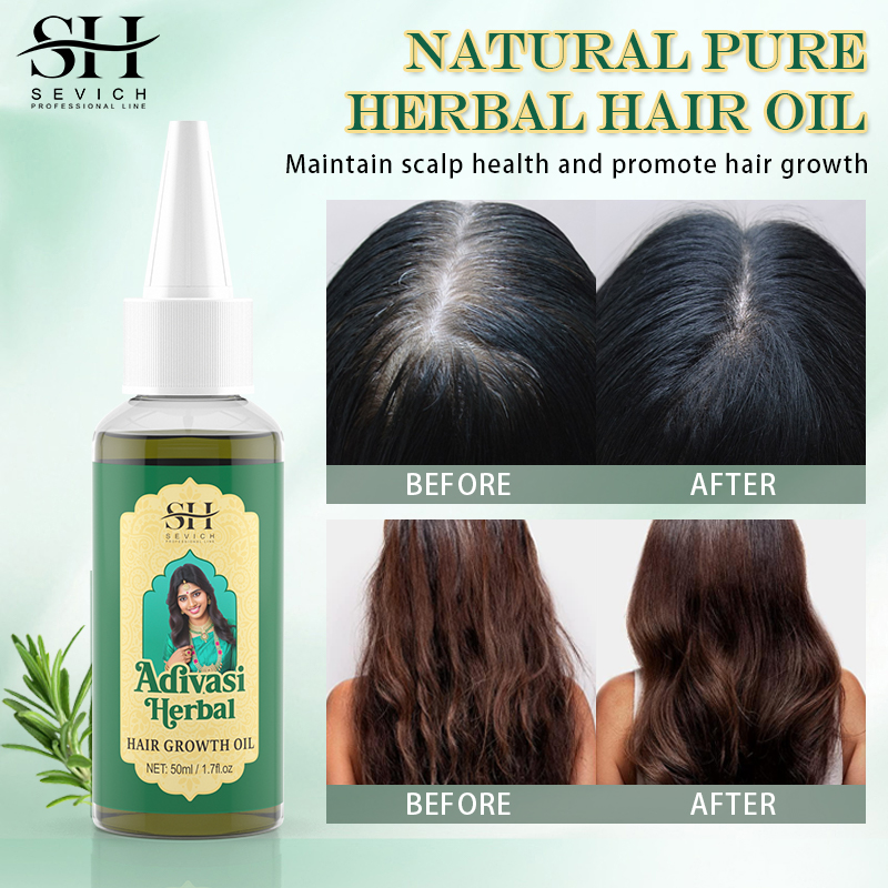 Ayurvedic Hair Growth Oil Adiv - Coconut Oil Refined 评论和价格